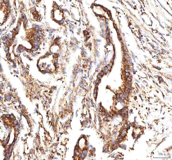 Calreticulin/CALR Antibody