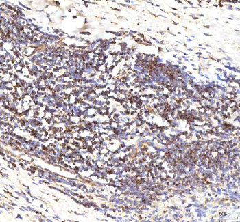 Calreticulin/CALR Antibody