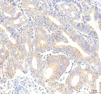 PKP2 Rabbit Polyclonal Antibody