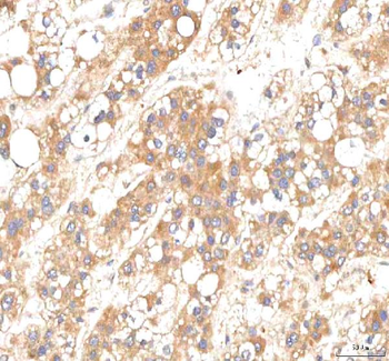PKP2 Rabbit Polyclonal Antibody