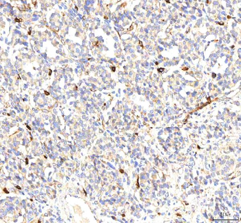 PKP2 Rabbit Polyclonal Antibody