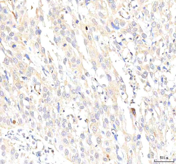 PKP2 Rabbit Polyclonal Antibody