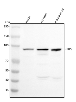 PKP2 Rabbit Polyclonal Antibody