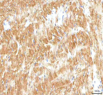 Hcn2 Antibody