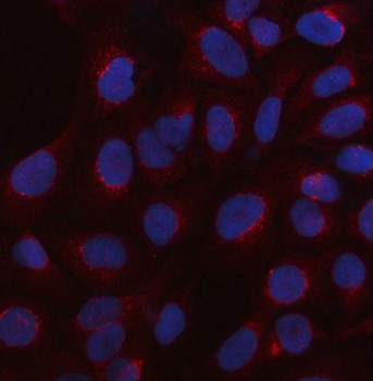 HTR3C Rabbit Polyclonal Antibody