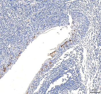 SGK493/PKDCC Antibody