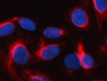 SGK493/PKDCC Antibody