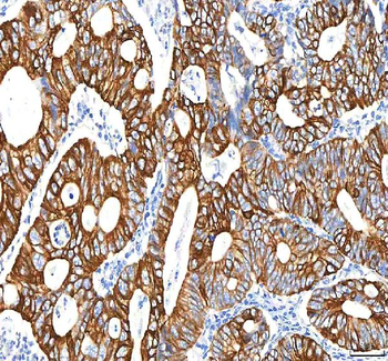 SGK493/PKDCC Antibody