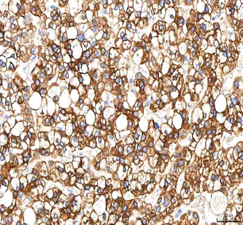 SGK493/PKDCC Antibody