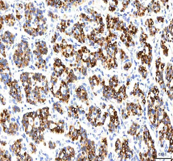 SGK493/PKDCC Antibody