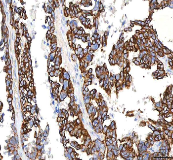 SGK493/PKDCC Antibody