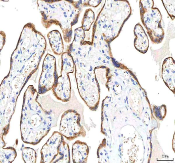 SGK493/PKDCC Antibody