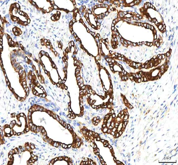 SGK493/PKDCC Antibody
