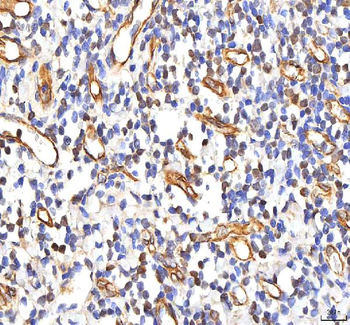 PHF6 Antibody