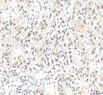 PHF6 Antibody