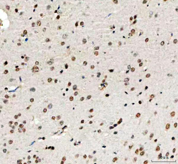 PHF6 Antibody