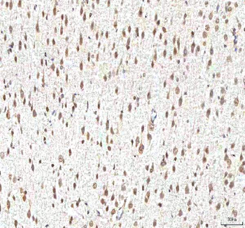 PHF6 Antibody