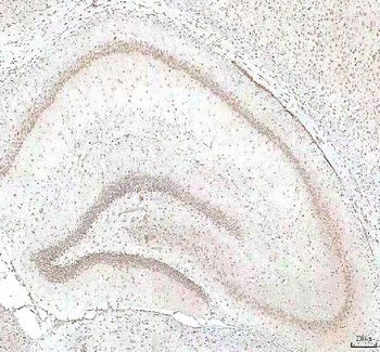 PHF6 Antibody