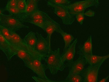 PHF6 Antibody
