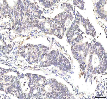 PHF6 Antibody