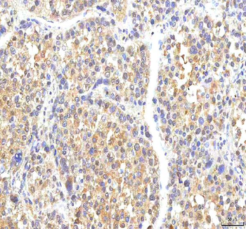 PHF6 Antibody