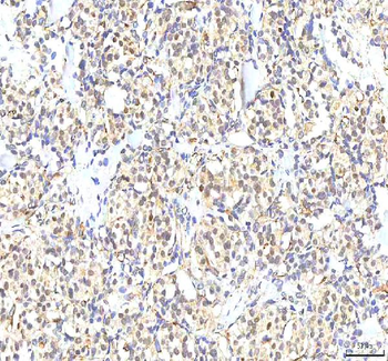 PHF6 Antibody