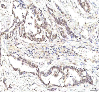 PHF6 Antibody