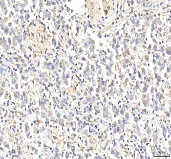 PHF6 Antibody