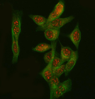 PGM3 Rabbit Polyclonal Antibody