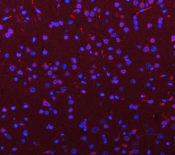 PGM3 Rabbit Polyclonal Antibody