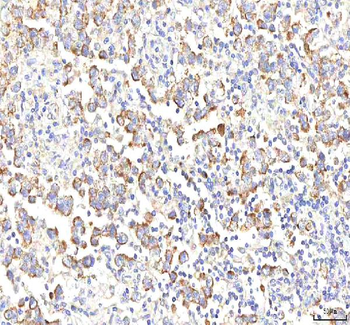 PGM3 Rabbit Polyclonal Antibody