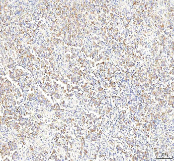 PGM3 Rabbit Polyclonal Antibody