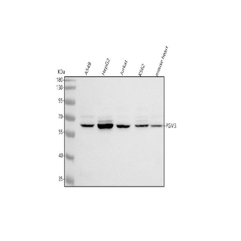 PGM3 Rabbit Polyclonal Antibody