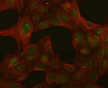 PGLS Rabbit Polyclonal Antibody
