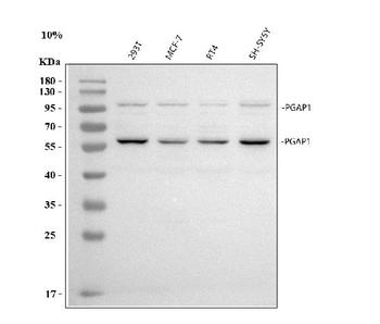 PGAP1 Rabbit Polyclonal Antibody