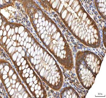 EIF3B Antibody