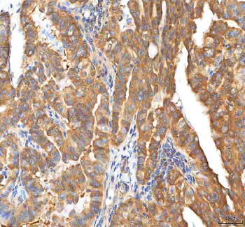 EIF3B Antibody