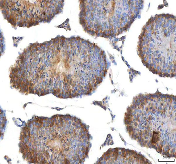 EIF3B Antibody