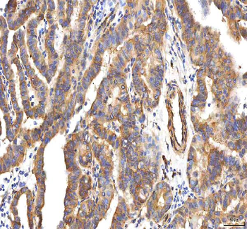 PCOLCE Rabbit Polyclonal Antibody