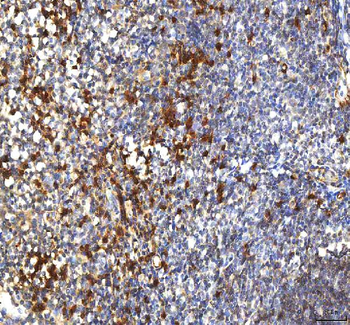 PCOLCE Rabbit Polyclonal Antibody
