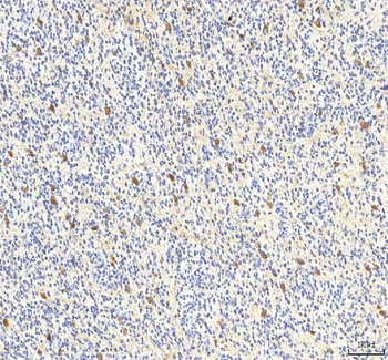PCMT1 Antibody