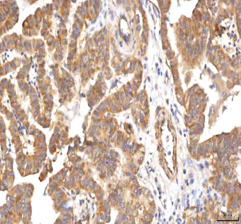PCMT1 Antibody