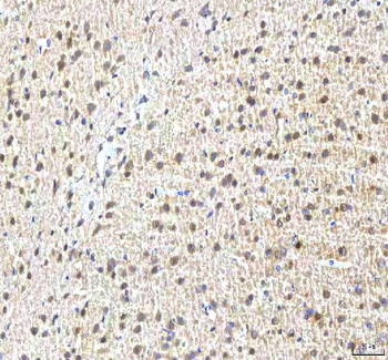 PCMT1 Antibody