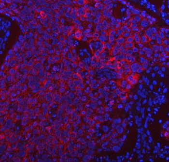 PDF Antibody