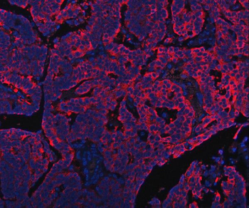 PDF Antibody