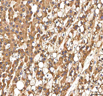 PDF Antibody