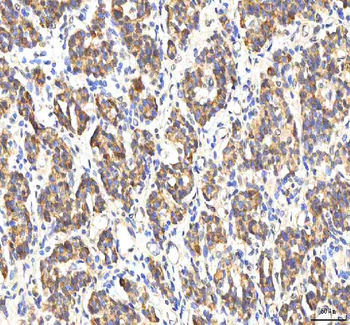 PDF Antibody