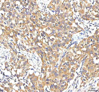 PDF Antibody