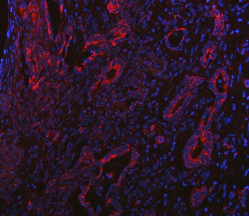 BCAT2 Antibody
