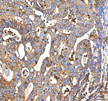 BCAT2 Antibody